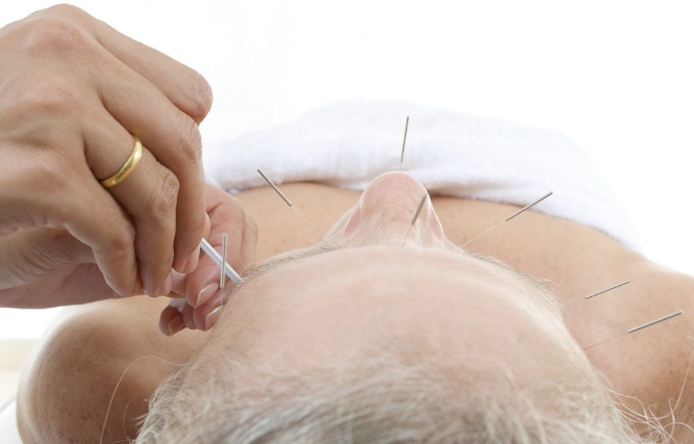 Can Acupuncture Give Arthritis Patients Relief?