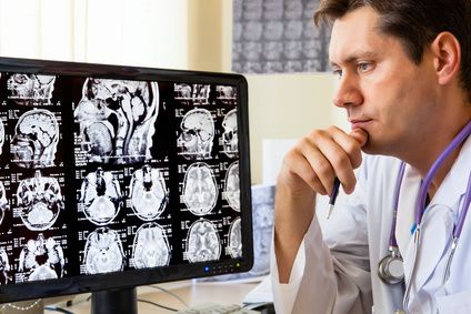B Vitamins and Stroke