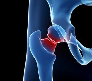 Calcium and Fractures