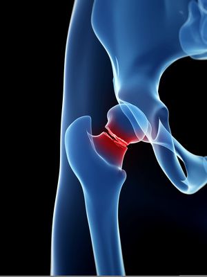 Calcium and Fractures