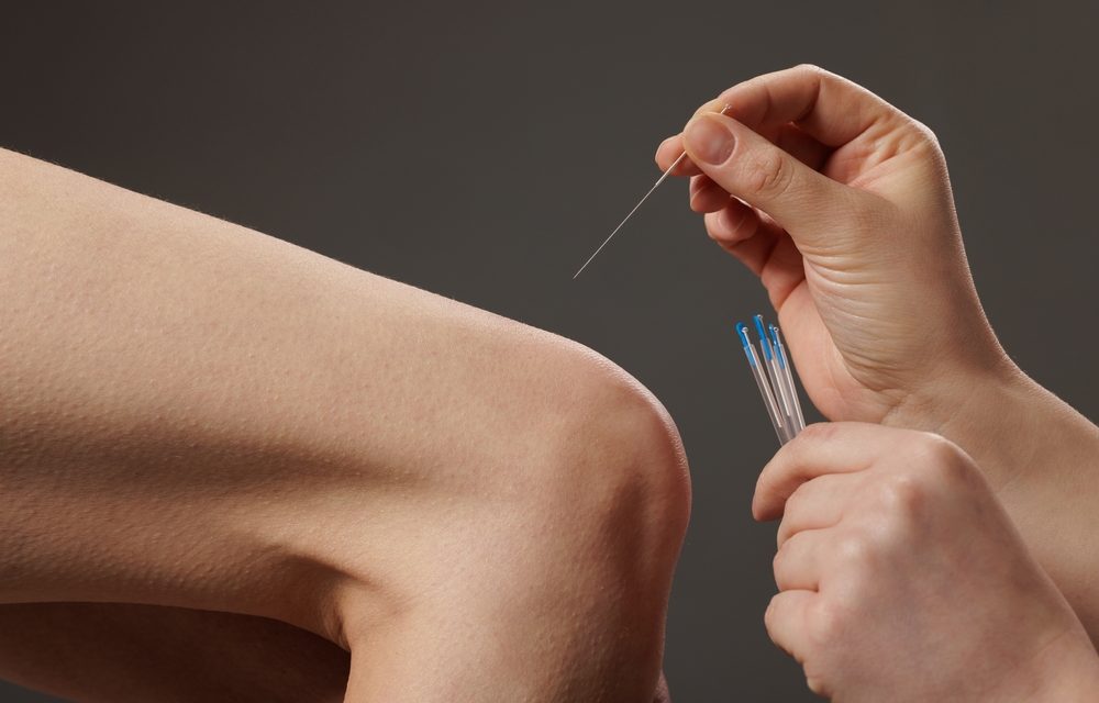 Acupuncture and Arthritis in the Knee