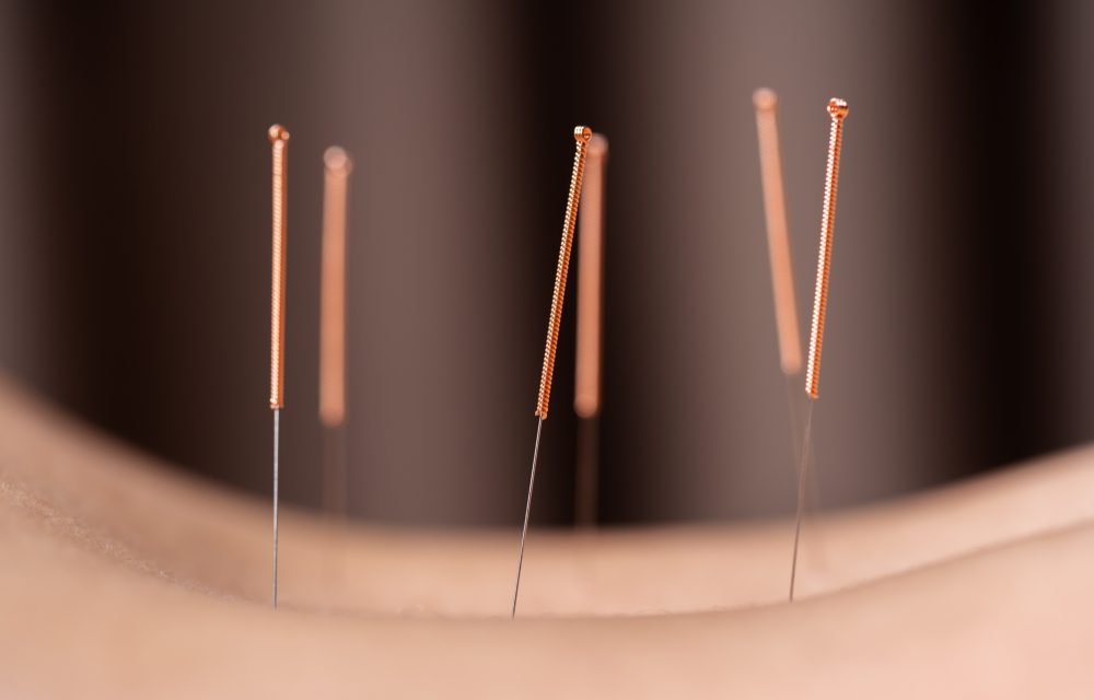 Acupuncture and Constipation