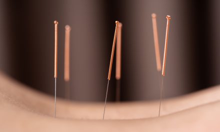 Acupuncture and Constipation