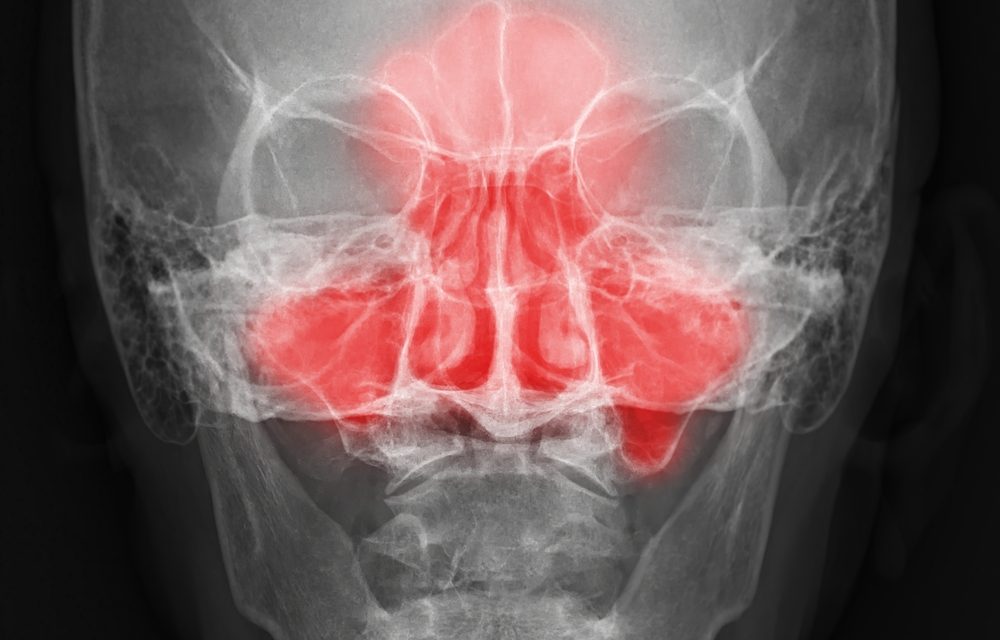 Fatigue? Maybe it’s Your Sinuses