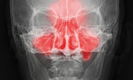 Fatigue? Maybe it’s Your Sinuses