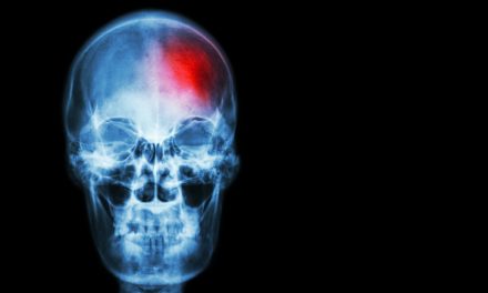 Will this Vitamin Help With Stroke Prevention?