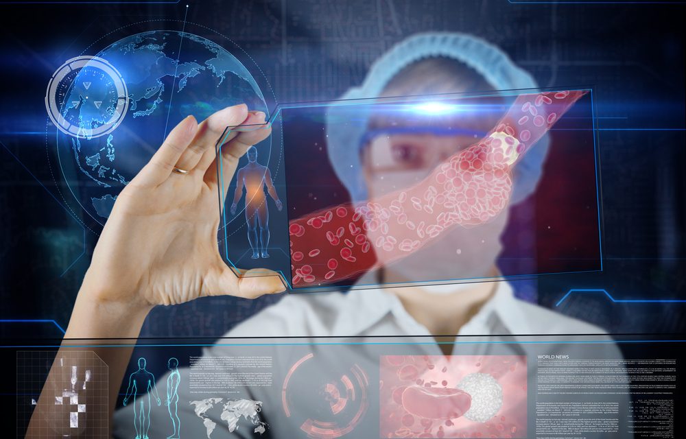Beyond Cholesterol: What you Absolutely Need to Know to Prevent Atherosclerosis and Heart Disease
