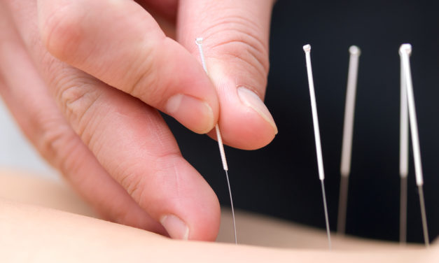 Research supports the use of Acupuncture for Several Conditions