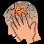 Headaches