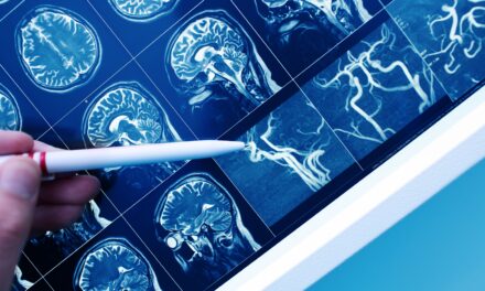 Benfotiamine and Brain Health: How Vitamin B1 May Help Protect Against Alzheimer’s Disease