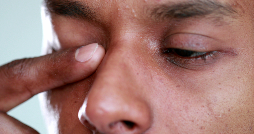 What to do About Itchy Allergy Eyes
