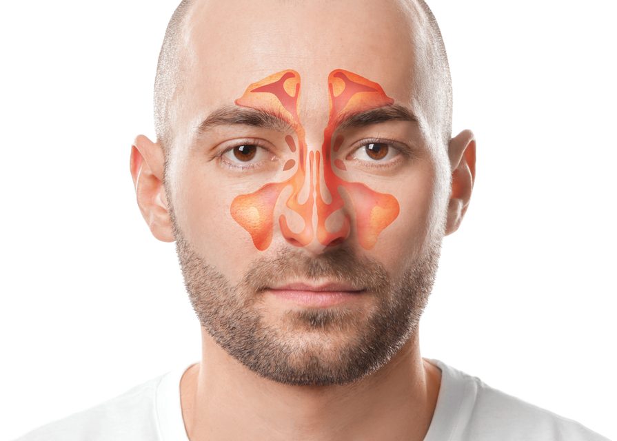 Understanding Chronic Sinus Problems: Why They Keep Coming Back