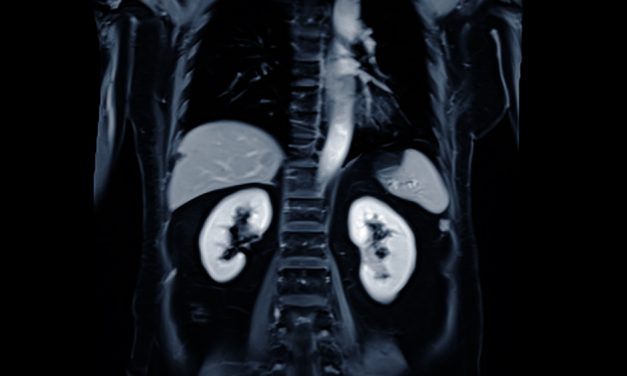 Painkillers and Kidney Health: What You Should Know