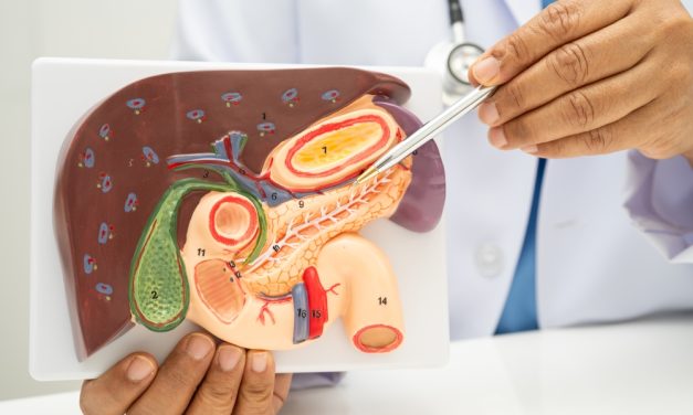 Biliary Stasis: Problems with Thick Bile