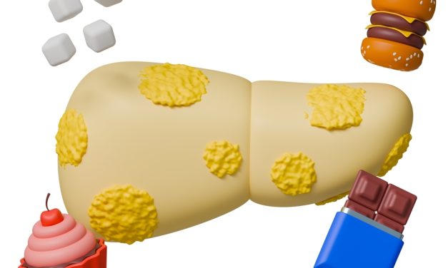 Berberine and Fatty Liver