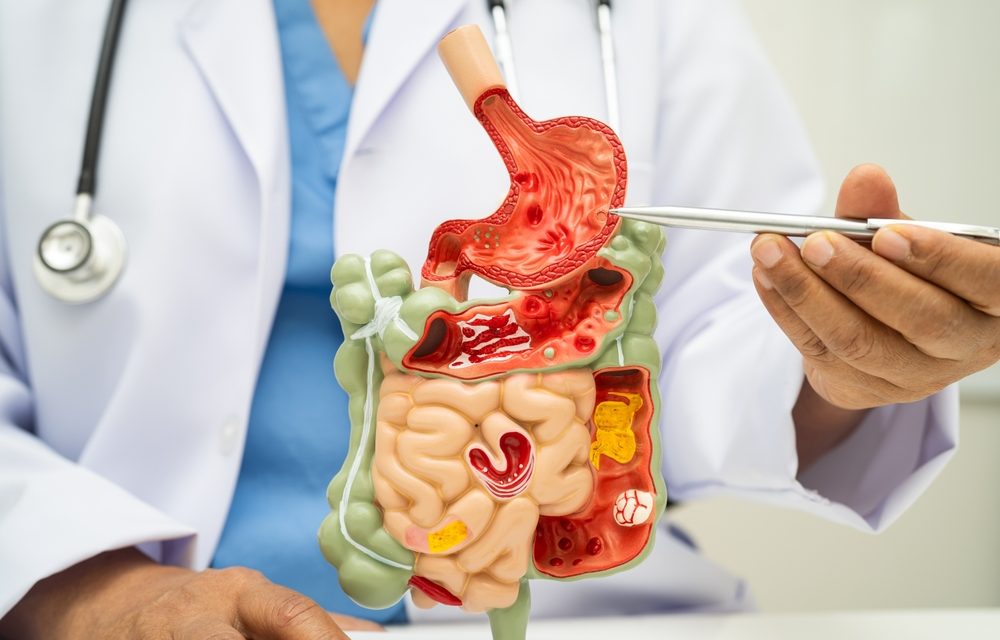 HCl and Digestive Enzymes: Why Digestion Breaks Down (and Why Most People Get It Wrong)