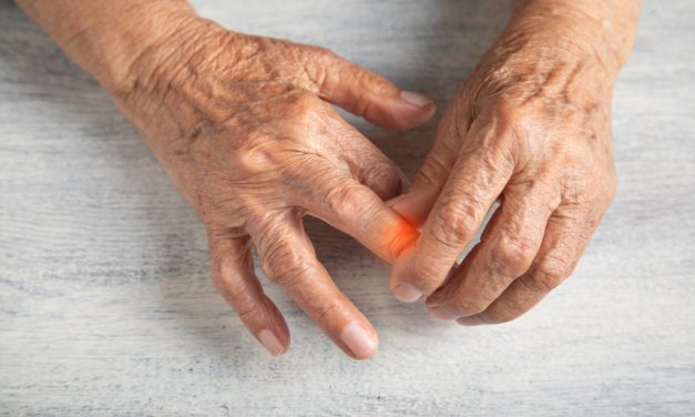 Arthritis and Chronic Inflammation