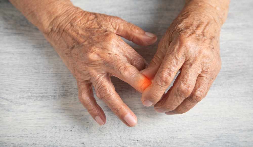 Arthritis and Chronic Inflammation