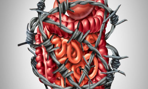 Irritable Bowel Syndrome & SIBO