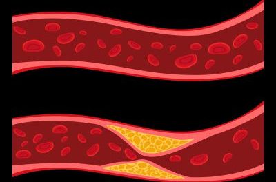 What Is the Endothelium? How Blood Vessels Regulate Blood Pressure and Heart Health