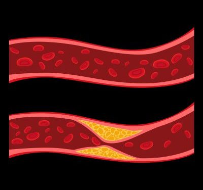 What Is the Endothelium? How Blood Vessels Regulate Blood Pressure and Heart Health