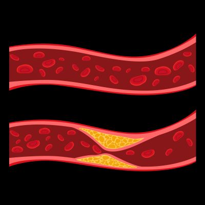 What Is the Endothelium? How Blood Vessels Regulate Blood Pressure and Heart Health