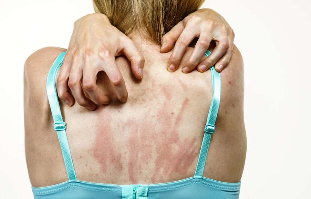 Itchy Skin? Rule Out These 2 Things