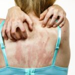 Itchy Skin? Rule Out These 2 Things