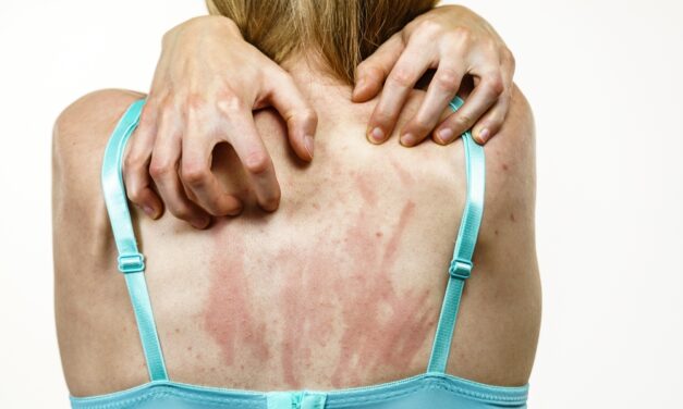 Itchy Skin? Rule Out These 2 Things