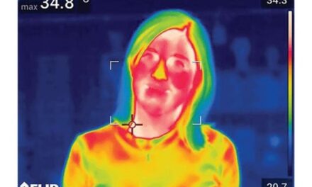 Inflammation and Menopausal Hot Flashes