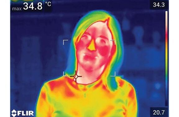 Inflammation and Menopausal Hot Flashes