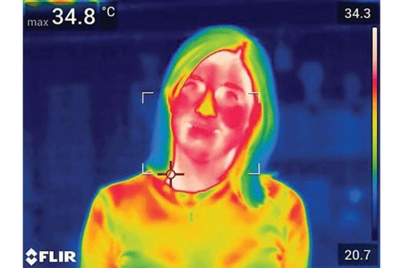 Inflammation and Menopausal Hot Flashes