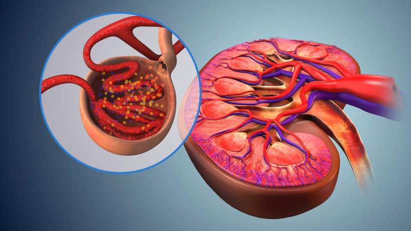 What Are Uremic Toxins?