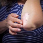 Dry Skin? Getting Sick Too Often? They May Have the Same Cause
