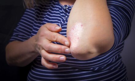Dry Skin? Getting Sick Too Often? They May Have the Same Cause