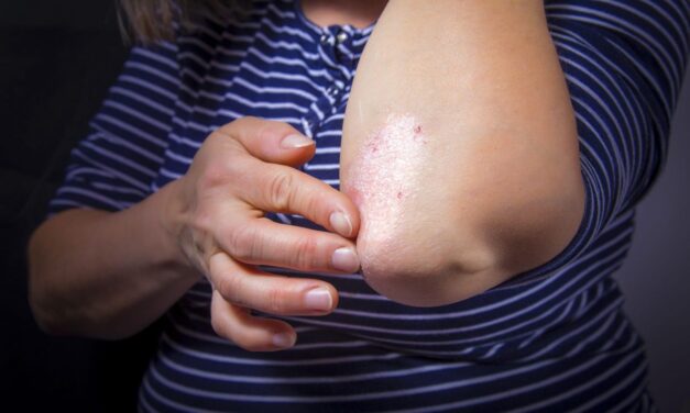 Dry Skin? Getting Sick Too Often? They May Have the Same Cause