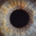 Dry Eyes? Check These Two Things First: Nutrients and Inflammation