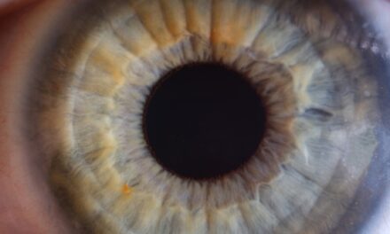 Dry Eyes? Check These Two Things First: Nutrients and Inflammation