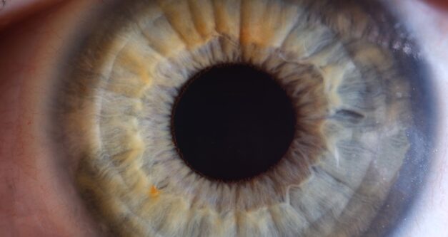 Dry Eyes? Check These Two Things First: Nutrients and Inflammation