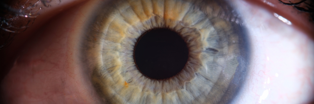 Dry Eyes? Check These Two Things First: Nutrients and Inflammation